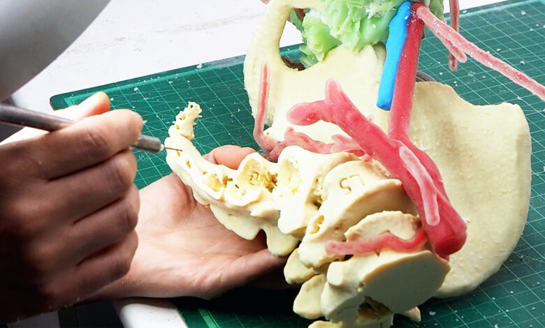 AIJU diseña un biomodelo impreso en 3D para cirugías tumorales complejas
